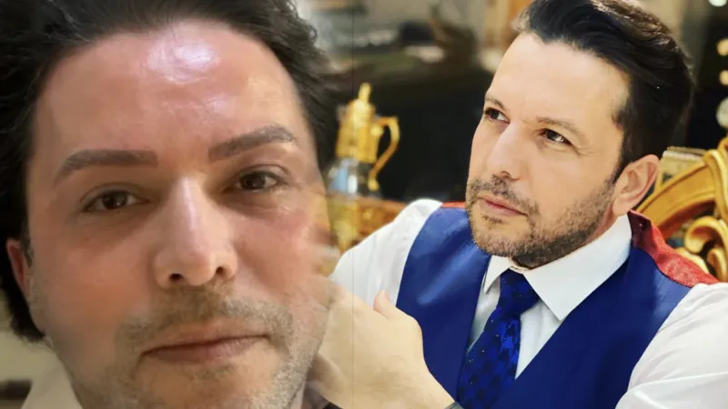 Nihat Doğan'dan Şaşırtan Değişim! Estetik Mi Yaptırdı?