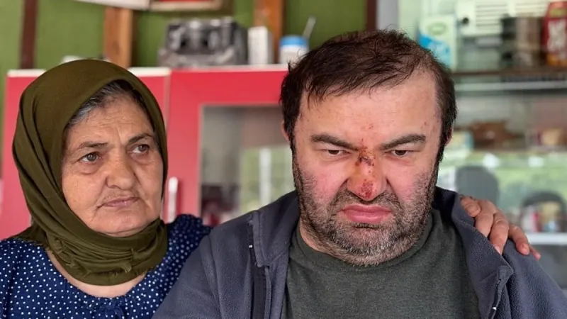 Engelli Adamı Akrabası mı Darp Etti? Şok İddia!